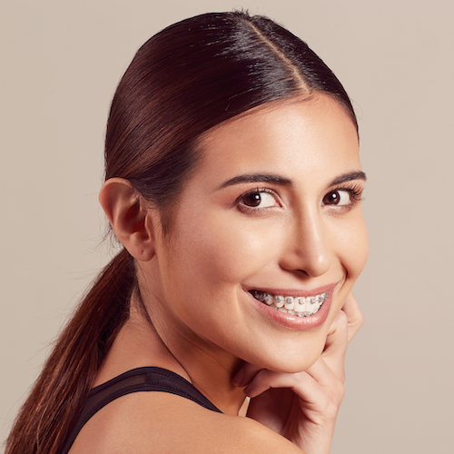 3 Benefits of Clear Braces - Alexandria Old Town Dental Alexandria Virginia