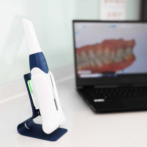 3D Intraoral Scanner Technology