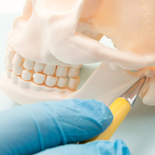 Temporomandibular Joint Disorder (TMD)